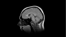 ebfenet_mri-snapshot.png